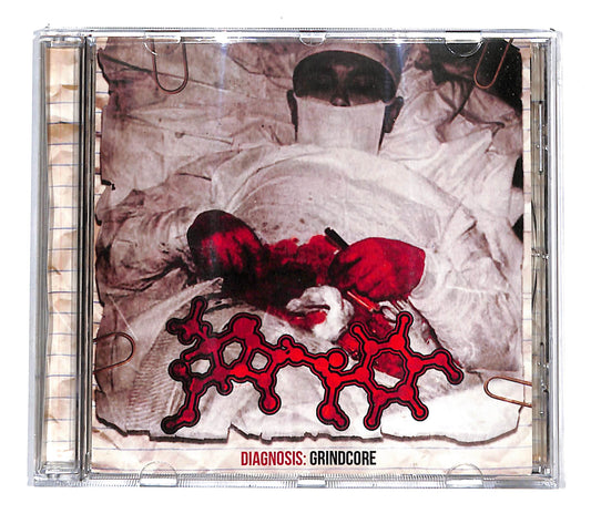 EBOND Amoclen - Diagnosis: Grindcore CD CD135811