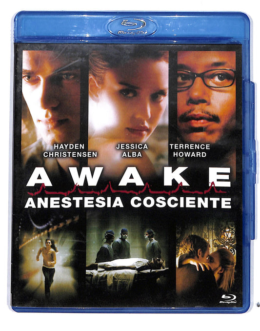 EBOND awake - anestesia cosciente BLURAY BLURAY DB689251