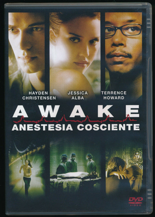 EBOND Awake Anestesia Cosciente NOLEGGIO DVD DB758919