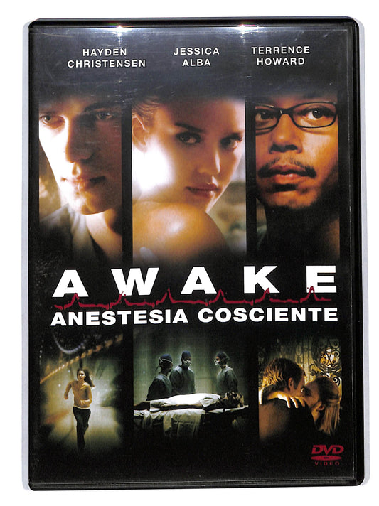 EBOND Awake - Anestesia Cosciente (2007) - EX NOLEGGIO DVD DB803617