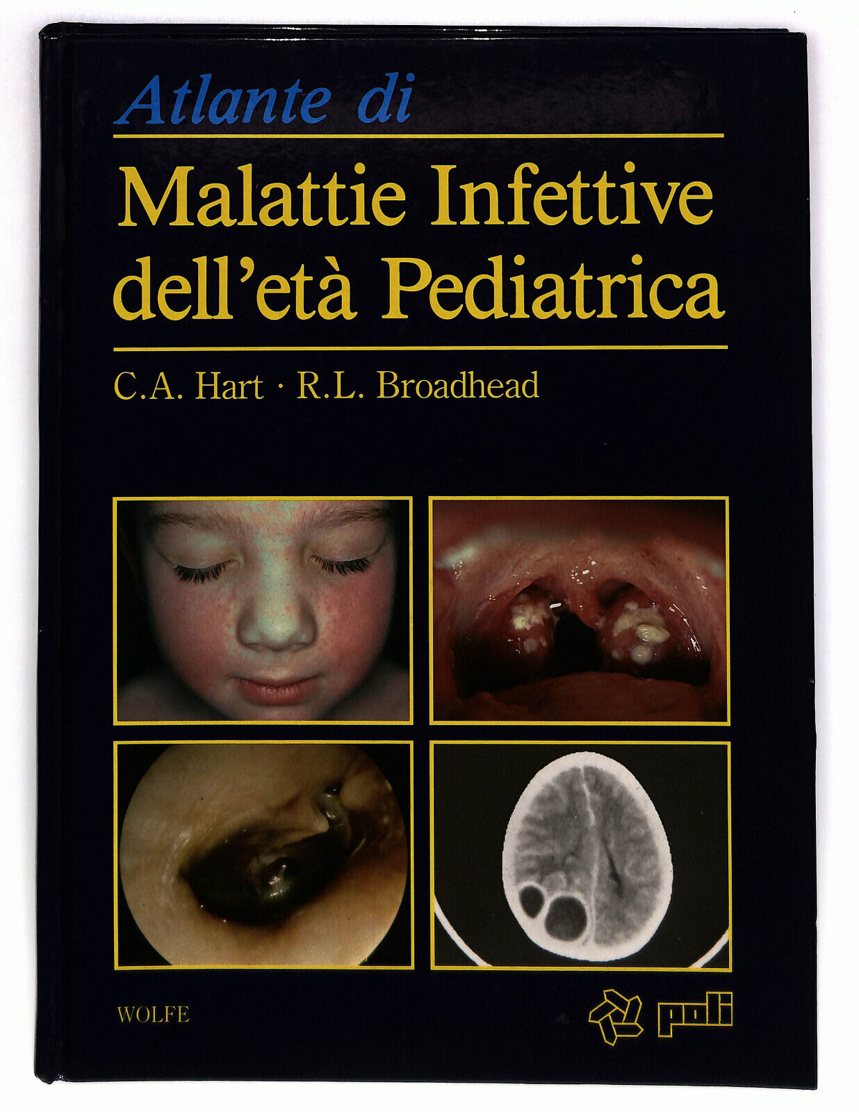 EBOND Atlante Di Malattie Infettive Dell'eta Pediatrica C.a. Hart Libro LI023406