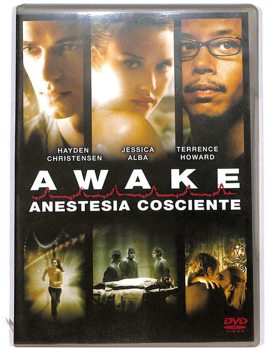 EBOND Awake Anestesia Cosciente  NOLEGGIO DVD D684744