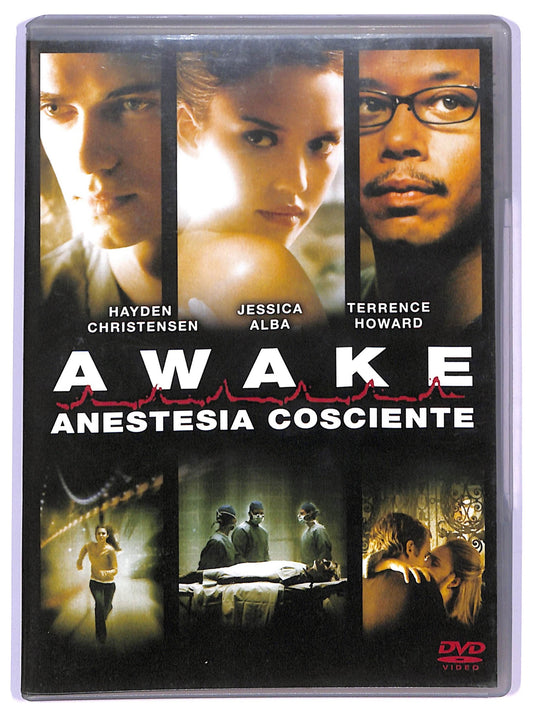 EBOND Awake Anestesia Cosciente  NOLEGGIO DVD D738723