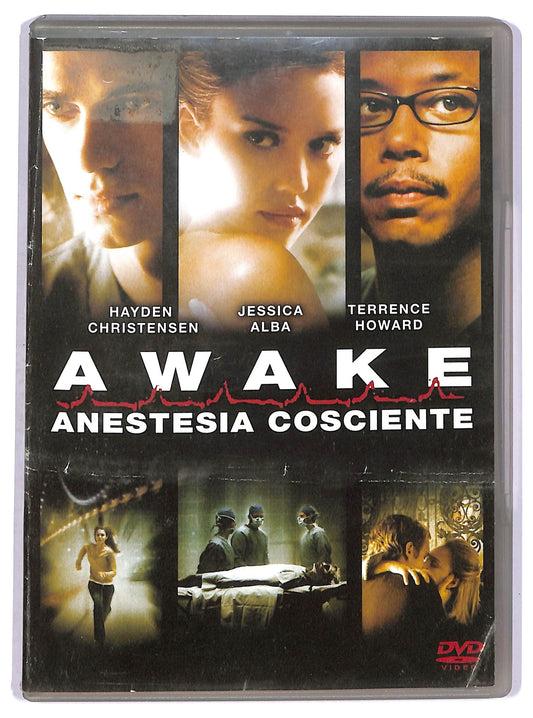 EBOND Awake Anestesia Cosciente DVD D750860
